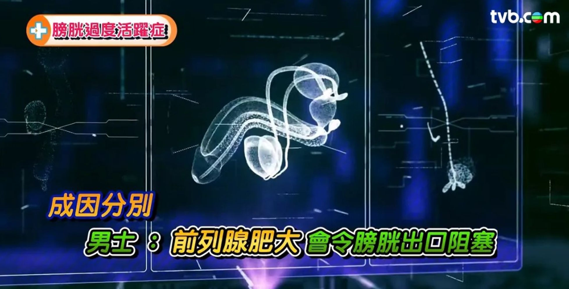 TVB節目《醫度講》：尿頻原因｜夜尿問題原來患上「膀胱過度活躍症」？