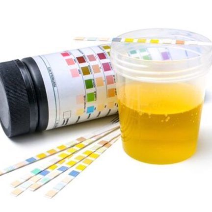 前列腺增生及下尿道症狀初步評估