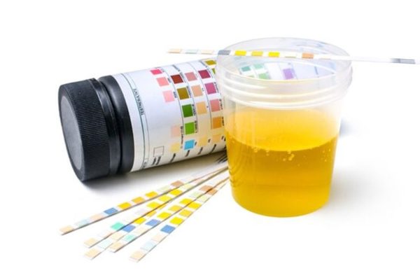 前列腺增生及下尿道症狀初步評估