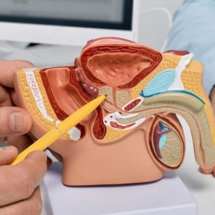 良性前列腺增生