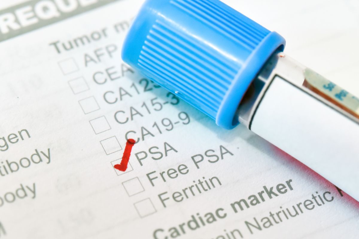 前列腺增生需做甚麽檢查？了解5大常見檢查方法及選擇