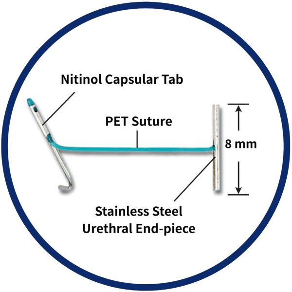 UroLift Implant Structure
