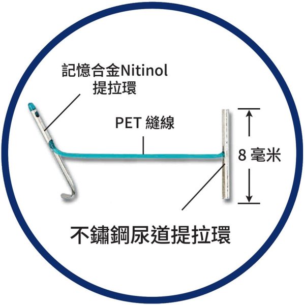 前列腺提拉術植入物結構