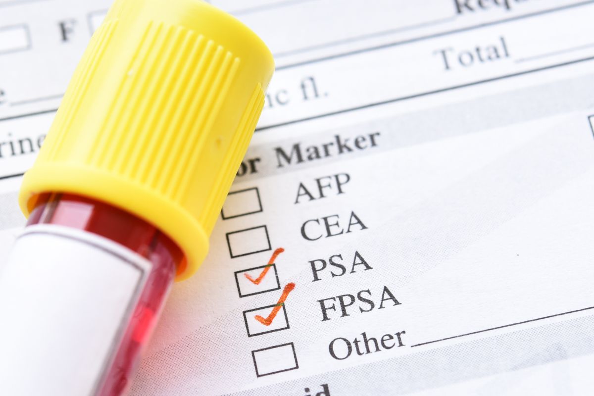 檢查報告看不懂「PSA」是甚麽？醫生帶你了解前列腺特異抗原